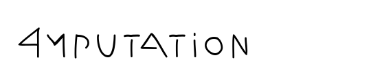 Amputation